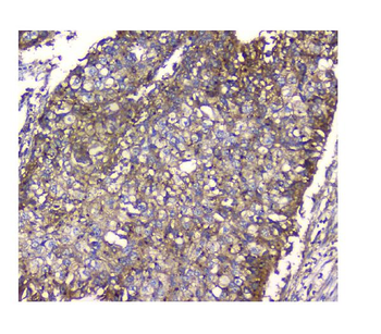 N myc interactor/NMI Rabbit Polyclonal Antibody
