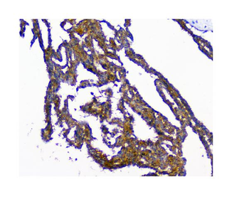 N myc interactor/NMI Rabbit Polyclonal Antibody