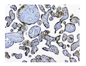 N myc interactor/NMI Rabbit Polyclonal Antibody