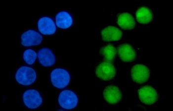 Nucleophosmin/NPM1 Rabbit Polyclonal Antibody