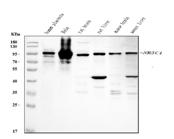 Glucocorticoid Receptor/NR3C1 Rabbit Polyclonal Antibody