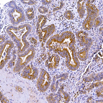 Optineurin/OPTN Rabbit Polyclonal Antibody