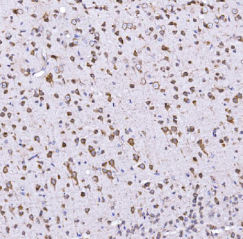 Optineurin/OPTN Rabbit Polyclonal Antibody