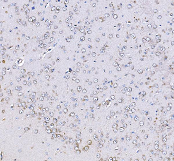 Optineurin/OPTN Rabbit Polyclonal Antibody