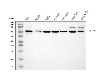 Optineurin/OPTN Rabbit Polyclonal Antibody