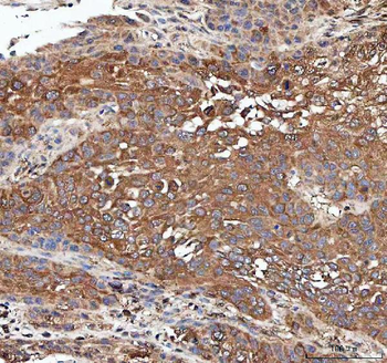 PP2A-alpha/PPP2CA/PP2A Rabbit Polyclonal Antibody