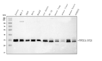 PP2A-alpha/PPP2CA/PP2A Rabbit Polyclonal Antibody