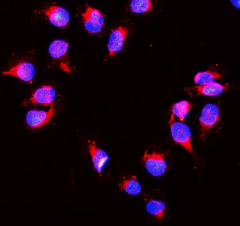 Peroxiredoxin 1/PRDX1 Rabbit Polyclonal Antibody