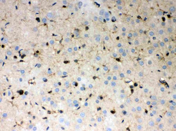 Peroxiredoxin 1/PRDX1 Rabbit Polyclonal Antibody