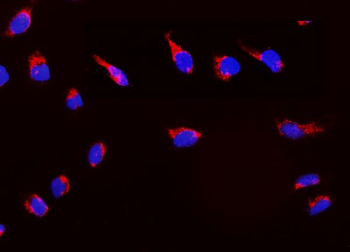 Peroxiredoxin 3/PRDX3 Rabbit Polyclonal Antibody