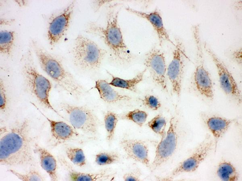Peroxiredoxin 3/PRDX3 Rabbit Polyclonal Antibody