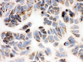 Peroxiredoxin 3/PRDX3 Rabbit Polyclonal Antibody