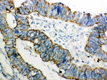 Peroxiredoxin 3/PRDX3 Rabbit Polyclonal Antibody