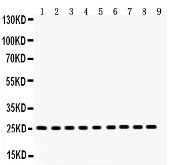 Peroxiredoxin 3/PRDX3 Rabbit Polyclonal Antibody