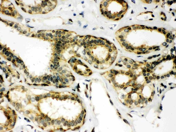 Peroxiredoxin 6/PRDX6 Rabbit Polyclonal Antibody
