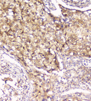 Peroxiredoxin 6/PRDX6 Rabbit Polyclonal Antibody