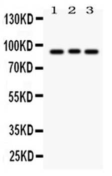 Semaphorin 3A/SEMA3A Rabbit Polyclonal Antibody