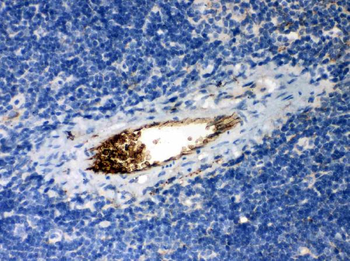 alpha 1 Antitrypsin/SERPINA1 Rabbit Polyclonal Antibody
