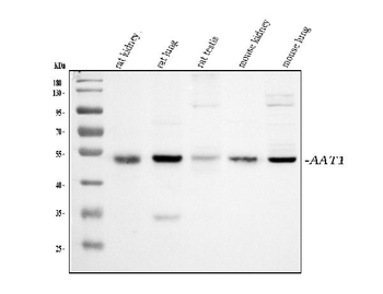 alpha 1 Antitrypsin/SERPINA1 Rabbit Polyclonal Antibody