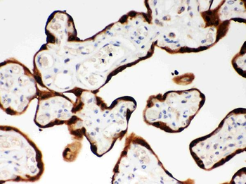 SerpinB2 Rabbit Polyclonal Antibody