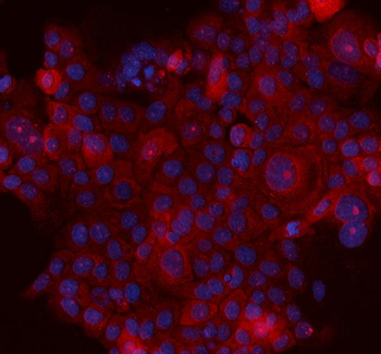 MASPIN/SERPINB5 Rabbit Polyclonal Antibody