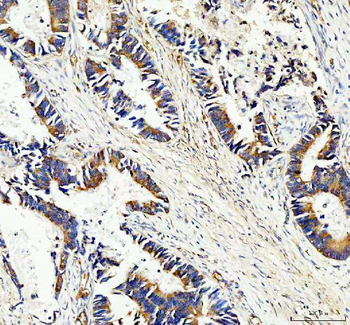 MASPIN/SERPINB5 Rabbit Polyclonal Antibody
