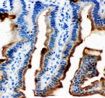 MASPIN/SERPINB5 Rabbit Polyclonal Antibody