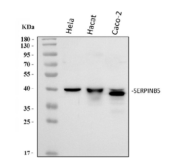 MASPIN/SERPINB5 Rabbit Polyclonal Antibody