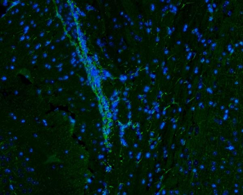 Vimentin Rabbit Polyclonal Antibody