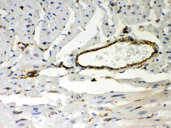 Vimentin Rabbit Polyclonal Antibody