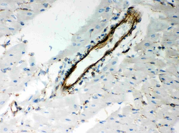 Vimentin Rabbit Polyclonal Antibody