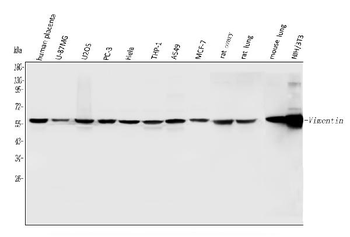 Vimentin Rabbit Polyclonal Antibody