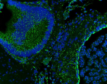Vimentin Rabbit Polyclonal Antibody