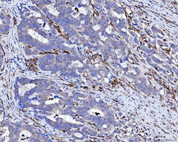 Vimentin Rabbit Polyclonal Antibody