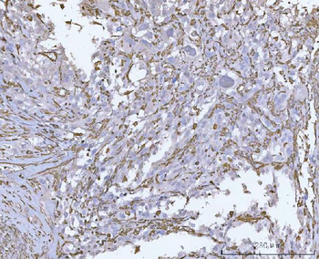 Vimentin Rabbit Polyclonal Antibody