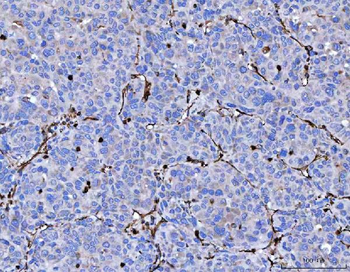 Vimentin Rabbit Polyclonal Antibody