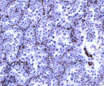 Vimentin Rabbit Polyclonal Antibody