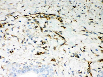Vimentin Rabbit Polyclonal Antibody