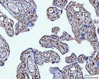 Vimentin Rabbit Polyclonal Antibody
