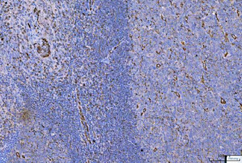 Vimentin Rabbit Polyclonal Antibody