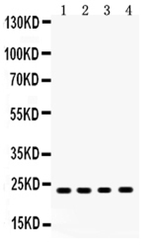 RBP4 Rabbit Polyclonal Antibody
