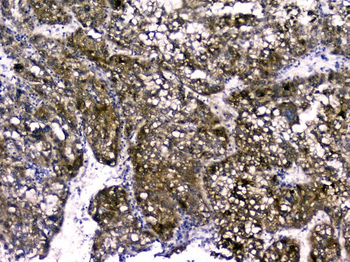 RBP4 Rabbit Polyclonal Antibody