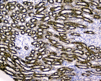 RBP4 Rabbit Polyclonal Antibody