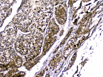 RBP4 Rabbit Polyclonal Antibody