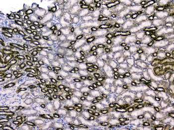 RBP4 Rabbit Polyclonal Antibody
