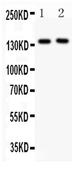 CD62P/SELP Rabbit Polyclonal Antibody