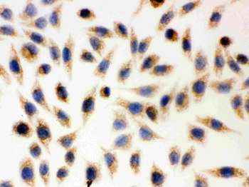 AIF/AIFM1 Rabbit Polyclonal Antibody