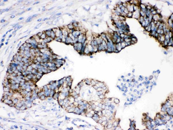 AIF/AIFM1 Rabbit Polyclonal Antibody