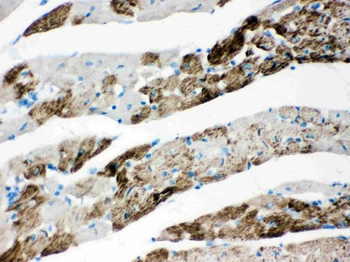 AIF/AIFM1 Rabbit Polyclonal Antibody