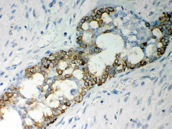 Caspase-7/CASP7 Rabbit Polyclonal Antibody
